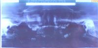 Kiefer R&ouml;ntgenaufnahmen 1999 - 2002